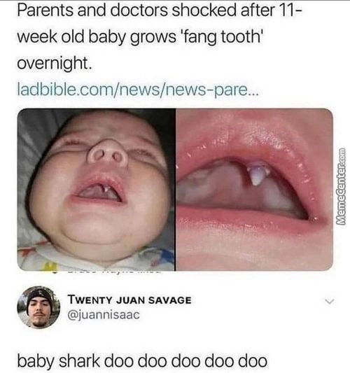 Parents And Doctors Shocked After 11-
Week Old Baby Grows 'fang Tooth'
Overnight.
Ladbible.com/news/news-pare...
TWENTY JUAN SAVAGE
@juannisaac
Baby Shark Doo Doo Doo Doo Doo
