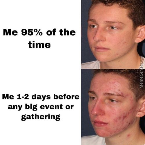 Me 95% Of The
Time
Me 1-2 Days Before
Any Big Event Or
Gathering
