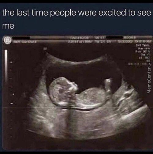The Last Time People Were Excited To See
Me
