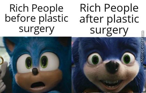 Rich People
Before Plastic
Surgery
Rich People
After Plastic
Surgery
